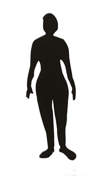 Figure 2: Hysteric type